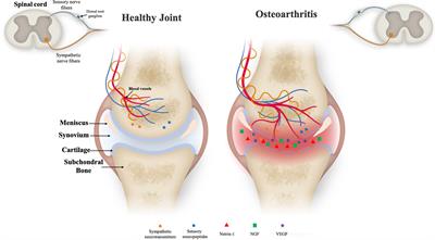 Cutting-Edge Technologies for Inflamed Joints on Chip: How Close Are We?